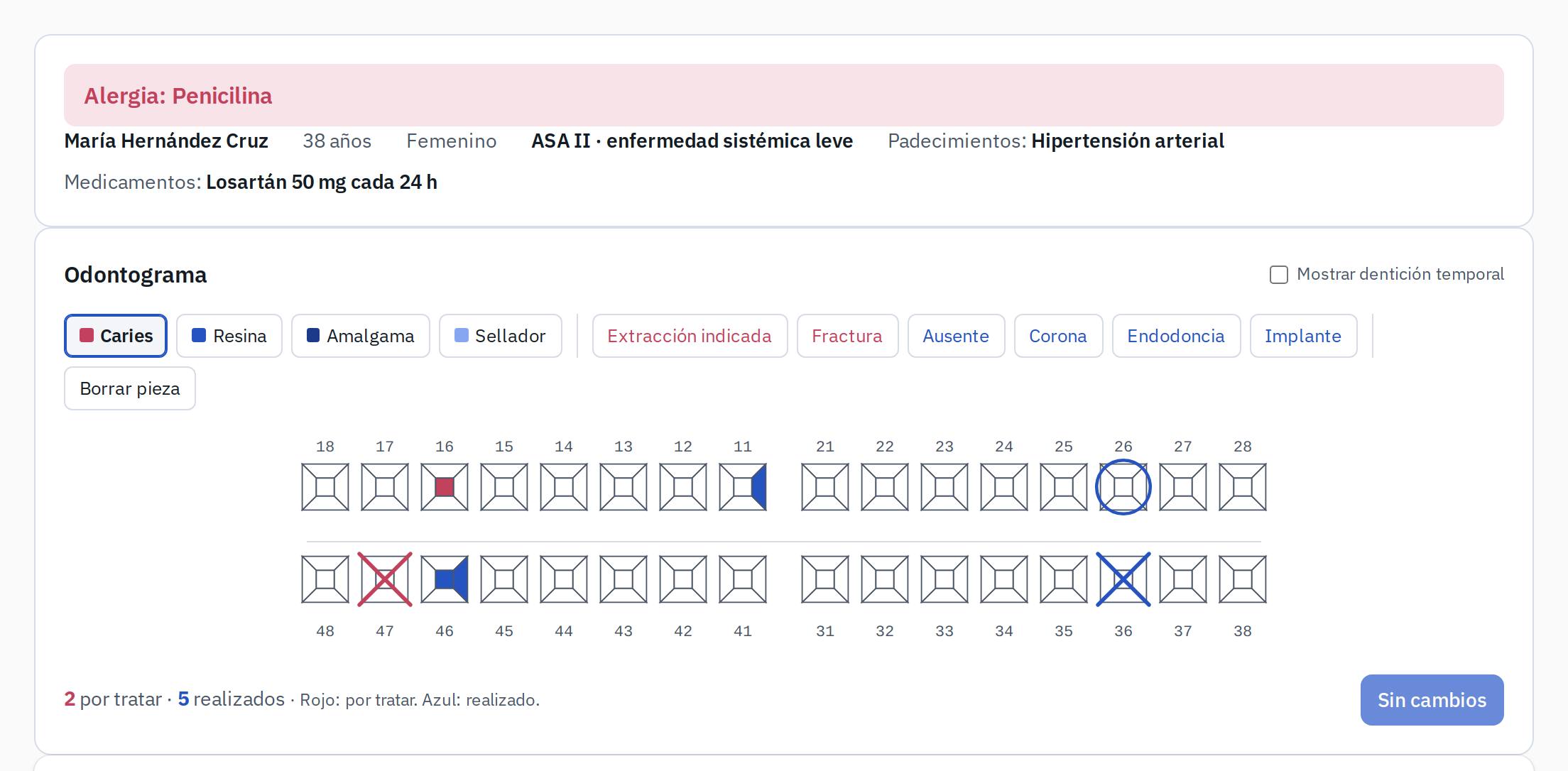 Expediente de un paciente con su alerta de alergia.